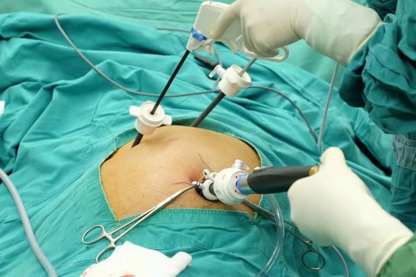 In-Vitro-Fertilization_2-1