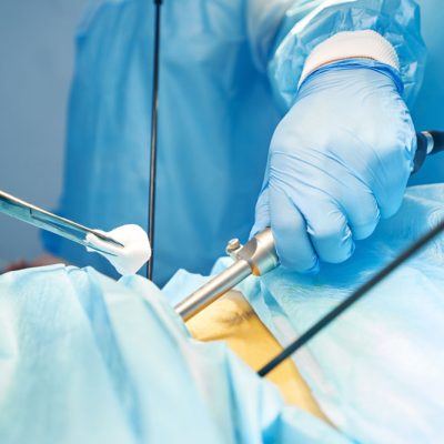 why-is-an-endoscopy-done why-is-an-endoscopy-done